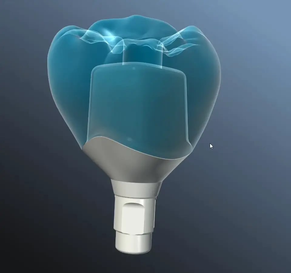 Transparent CoDesign crown revealing the abutment inside, extracted from the demonstration