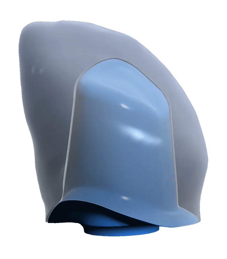 Illustration of separate crown and abutment geometry