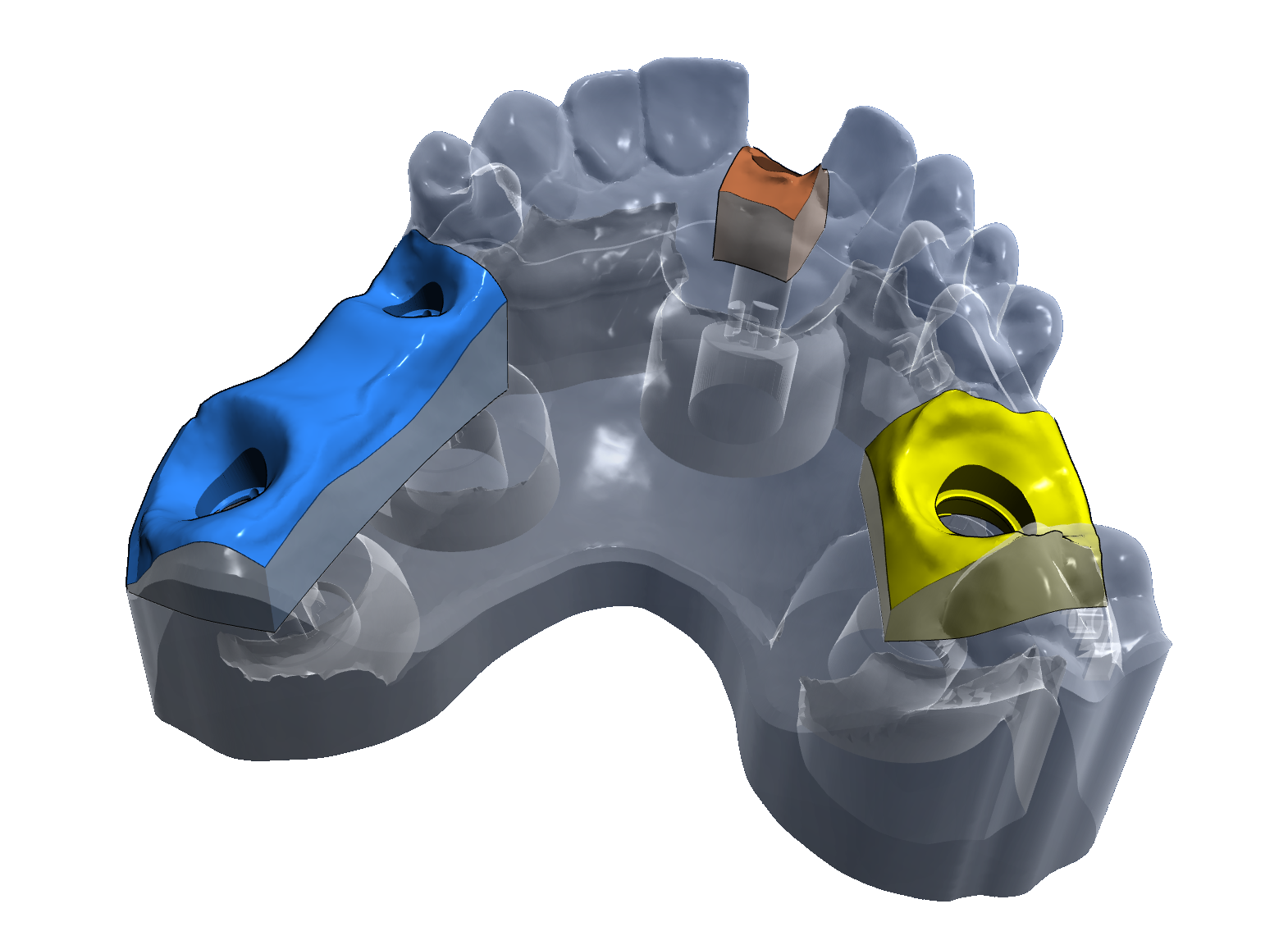 Dental 3D geometry preparation example with feature segmentation